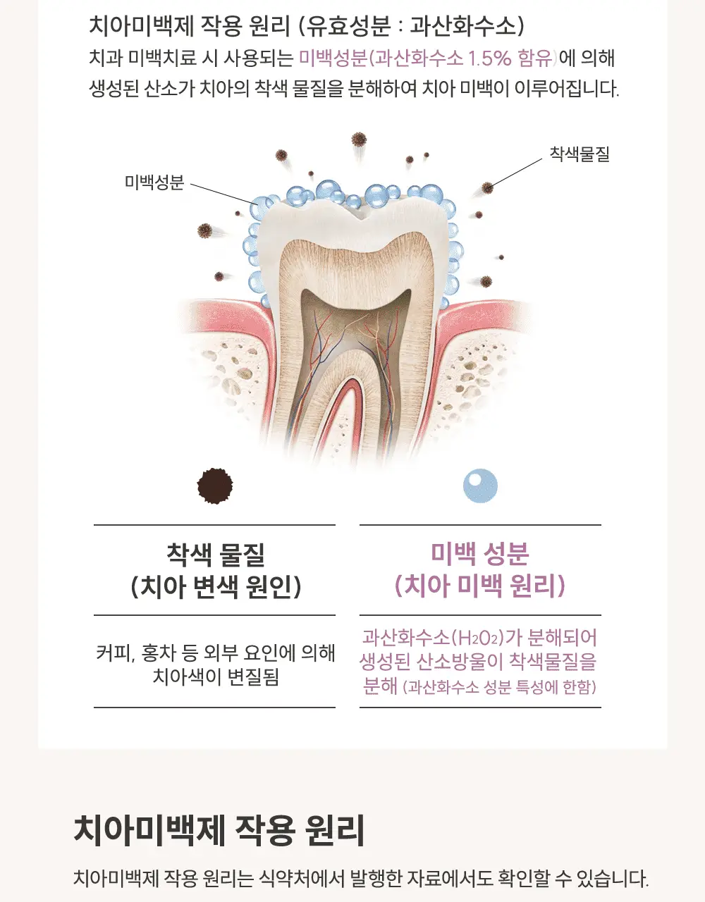 [데일리 미백케어] 뷰센15 치아미백제 80g 기획팩 (+더블와이드 칫솔 증정) 상세페이지 14